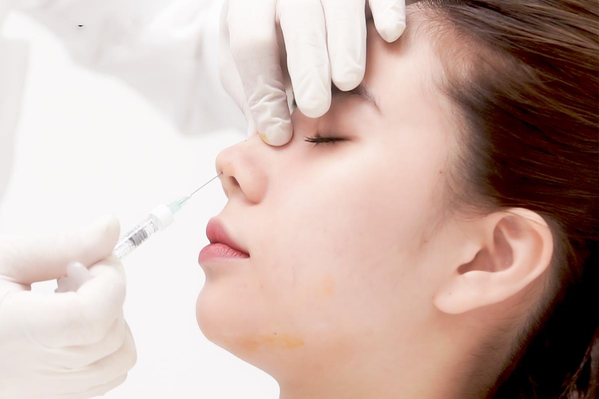 Chọn nơi tiêm nâng mũi filler uy tín, tay nghề bác sĩ cao