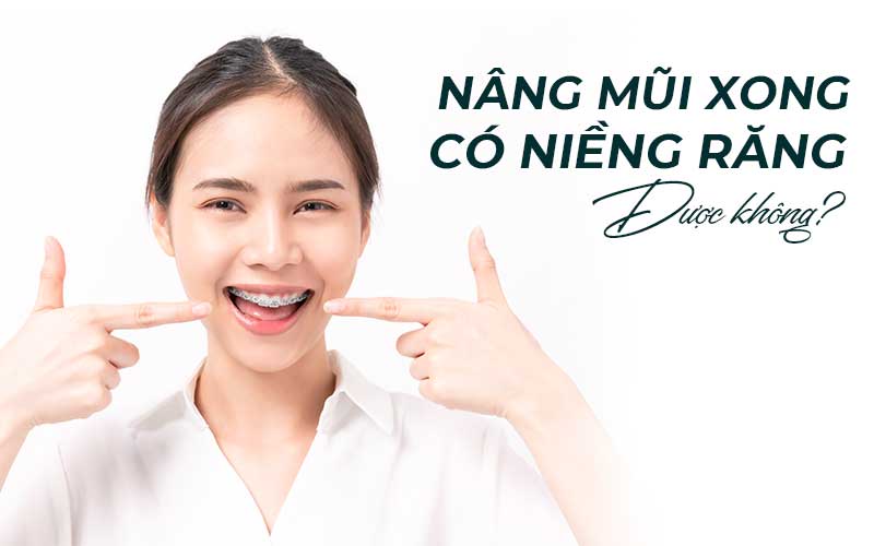 Niềng răng trước hay sau nâng mũi phụ thuộc vào nhu cầu và tình trạng của mỗi người