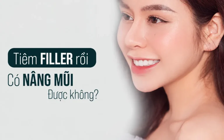 Tiêm filler rồi có nâng mũi được không và thời điểm phù hợp để phẫu thuật