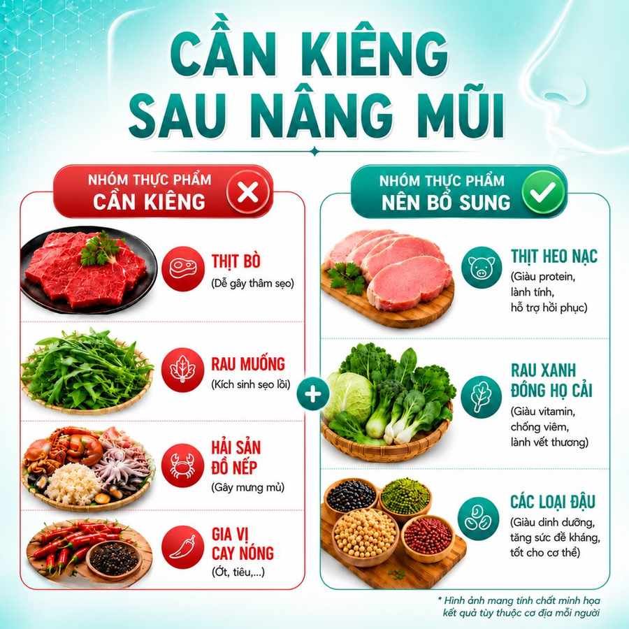 các thực phẩm nên ăn và cần kiêng sau nâng mũi, hỗ trợ quá trình hồi phục và hạn chế sưng viêm.