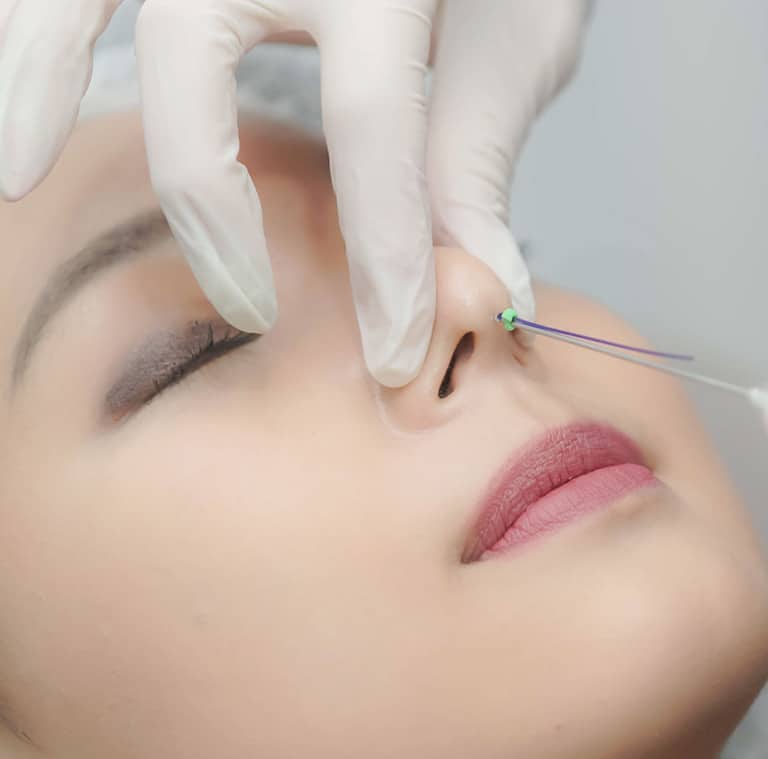 Nâng mũi chỉ là phương pháp an toàn được nhiều chị em lựa chọn