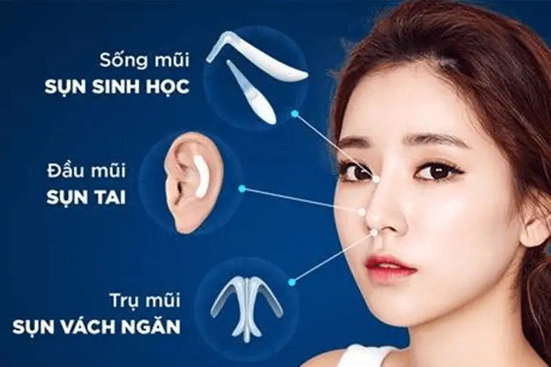 Giá nâng mũi Hàn Quốc phụ thuộc vào chất liệu sụn và phương pháp nâng mũi.