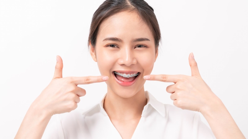Nâng mũi và niềng răng hoàn toàn không ảnh hưởng đến nhau