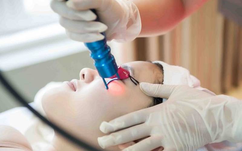 Làn da sau khi bắn laser sẽ vô cùng nhạy cảm, cần được chăm sóc cẩn thận