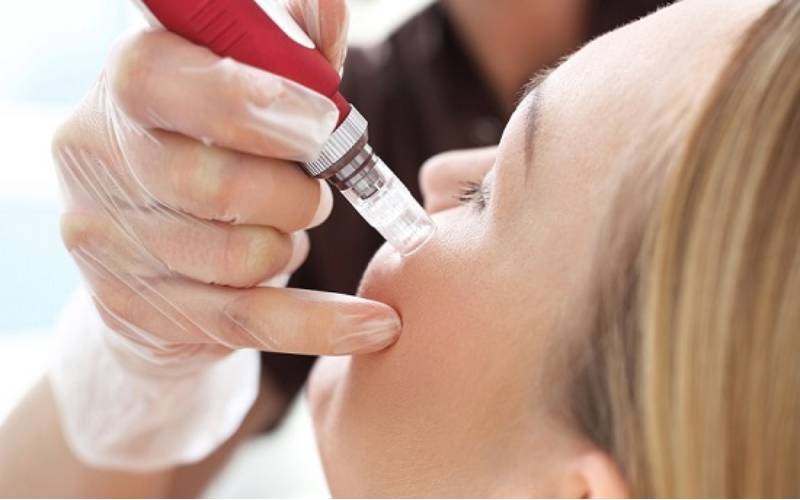 Da sau phi kim rất nhạy cảm, vì vậy cần phải có quy trình chăm sóc thật cẩn thận