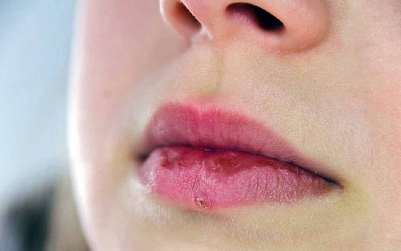 Với tình trạng nặng, cần phải có sự tư vấn của chuyên gia hoặc bác sĩ để xử lý