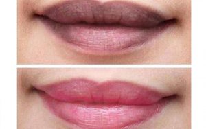 Khử thâm môi giúp lấy lại màu môi tự nhiên nhất