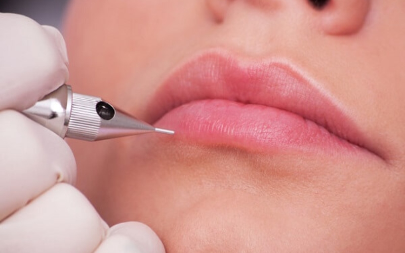  Tùy cơ địa mỗi người mà thời gian phục hồi sau khi phun môi khác nhau