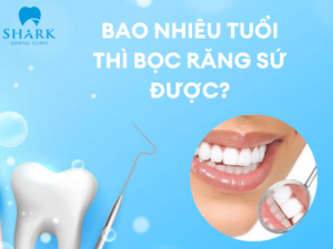 Bao nhiêu tuổi thì bọc răng sứ được
