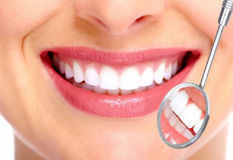 Quy trình bọc răng sứ mất bao lâu và thực hiện như thế nào?