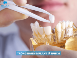 Trồng răng implant tại TPHCM