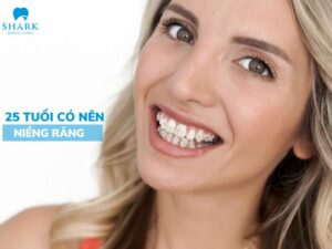 25 tuổi có niềng răng được không
