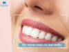 Tẩy trắng răng giá bao nhiêu tiền? Bảng giá mới 2026