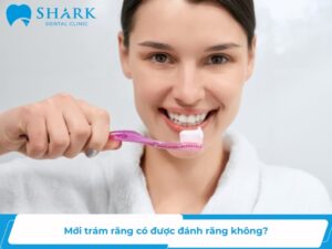 mới trám răng có được đánh răng không