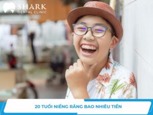 20 tuổi niềng răng bao nhiêu tiền