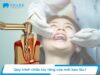 Khi nào cần chữa tủy răng cửa? Giá trị viêm tủy răng cửa