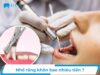 Nhổ răng khôn bao nhiêu tiền? Chi phí mới tháng 9/2026