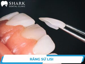 răng sứ Lisi