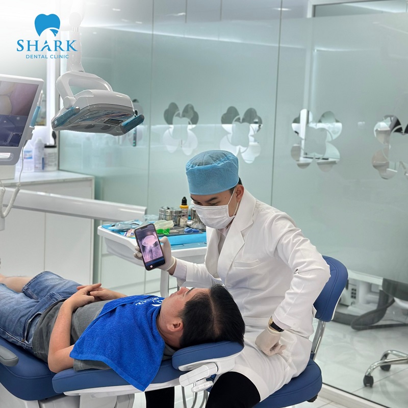 Tái khám định kỳ khi niềng răng