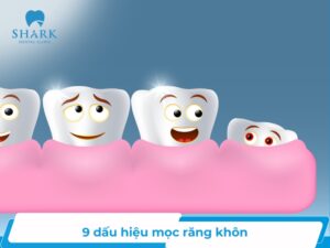 dau hieu moc rang khon