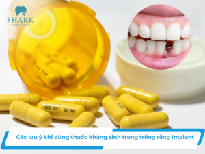 Các lưu ý khi dùng thuốc kháng sinh trong trồng răng Implant