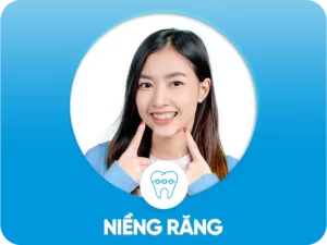 Niềng răng thẩm mỹ