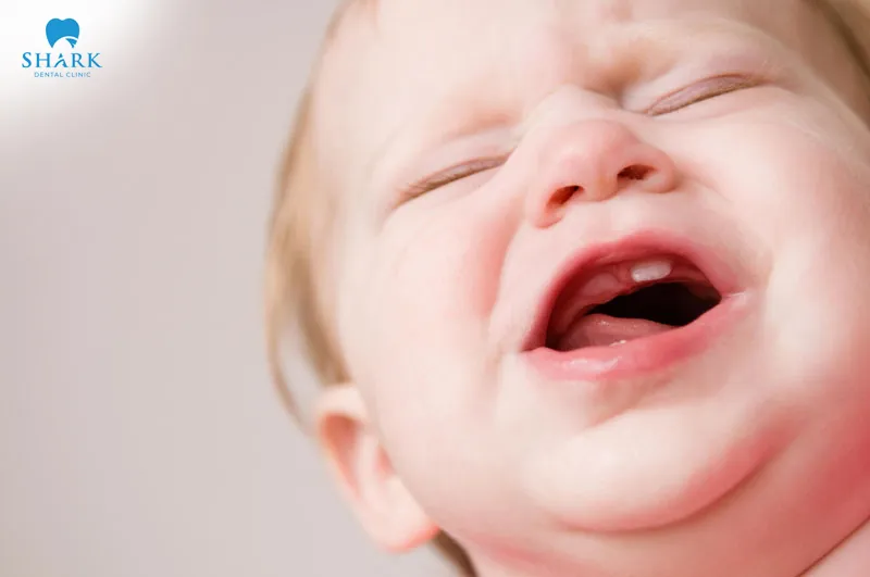 Trẻ sốt 39 độ mọc răng kéo dài có thể là do các triệu chứng khác ảnh hưởng