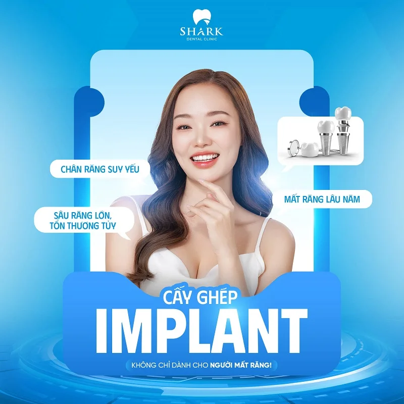 Cấy ghép Implant là gì? Trường hợp nào được chỉ định trồng? 11 Thăm khám trước khi cấy ghép Implant là điều kiện tiên quyết khi trồng răng