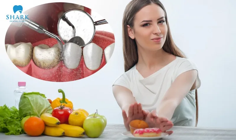 Cạo vôi răng xong kiêng những món ngọt, đồ ăn lạnh có thể gây ê buốt răng