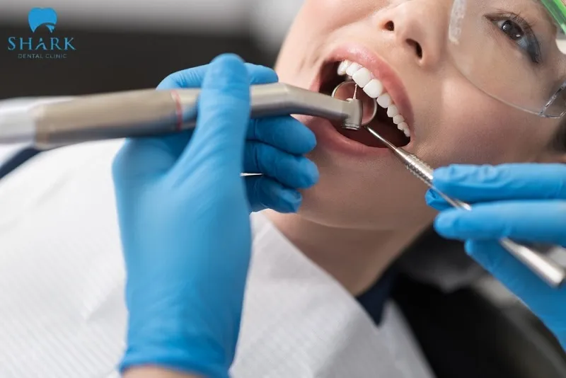 Bác sĩ giải đáp: Bị nha chu có bọc răng sứ được không? 7 Bác sĩ sẽ kê thuốc kháng sinh và tiến hành cạo vôi răng để làm sạch vùng chân răng