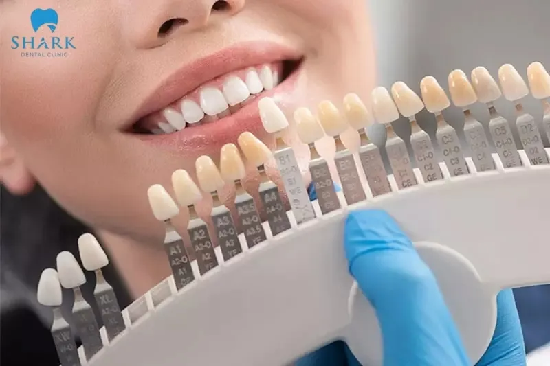 Bọc răng sứ Ceramill là gì? Những thông tin cần biết 10 Răng sứ Ceramill Zi có nhiều bảng màu khác nhau, bạn có thể lựa chọn