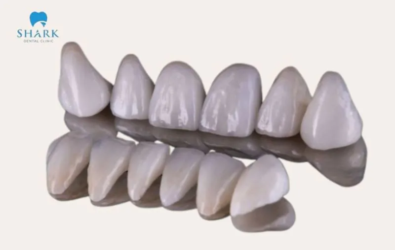 Bọc răng sứ có được bảo hiểm không? Giải đáp chi tiết từ A-Z 14 Bọc răng toàn sứ thường có giá cao hơn so với răng sứ kim loại