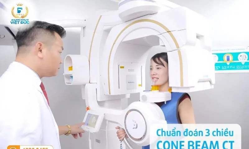Top 12 địa chỉ bọc răng sứ tại Hà Nội uy tín và an toàn 24 Công nghệ hiện đại chẩn đoán 3 chiều Cone Beam CT