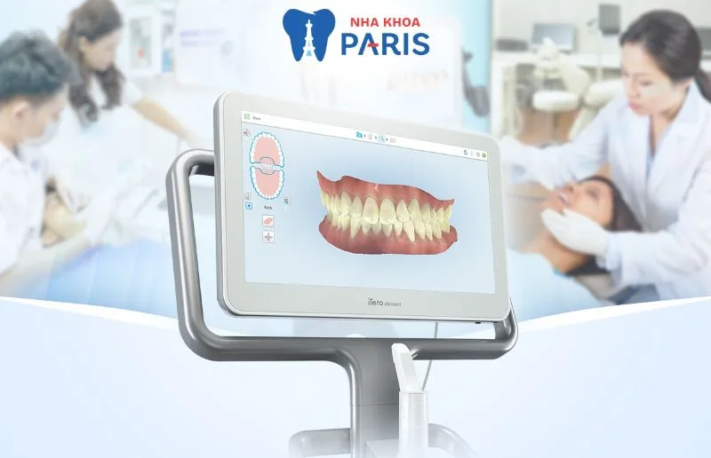 Top 12 địa chỉ bọc răng sứ tại Hà Nội uy tín và an toàn 25 Công nghệ Scan 3D iTero giúp nha khoa Paris ghi lại hình ảnh toàn bộ cấu trúc răng chính xác gần như tuyệt đối