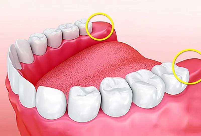 Tại sao lại không mọc răng khôn? Có ảnh hưởng gì không? 4 Răng khôn không mọc bạn cũng đừng quá lo lắng điều này