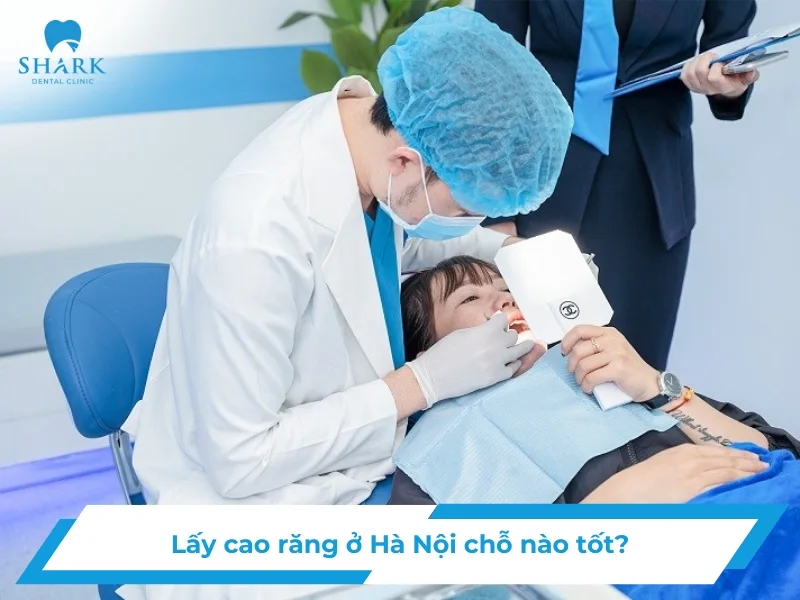Lấy cao răng uy tín ở Hà Nội