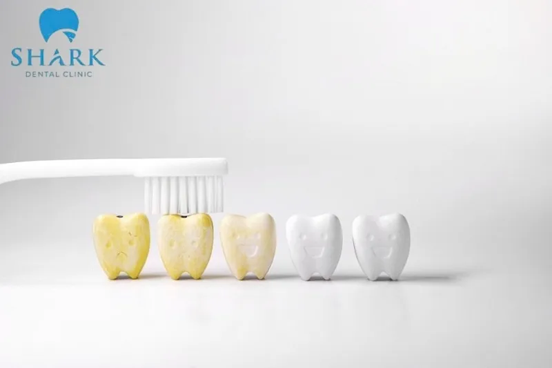 Có nên sử dụng miếng dán trắng răng Crest không? 7 Miếng dán trắng răng Crest 3D White phù hợp với những trường hợp răng bị ố vàng nhẹ đến trung bình