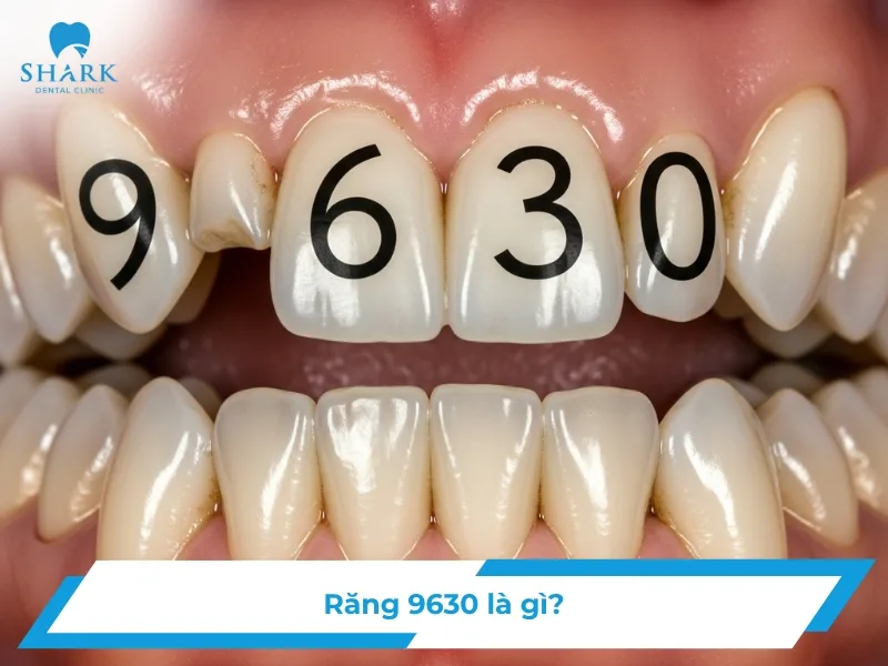 Răng 9630