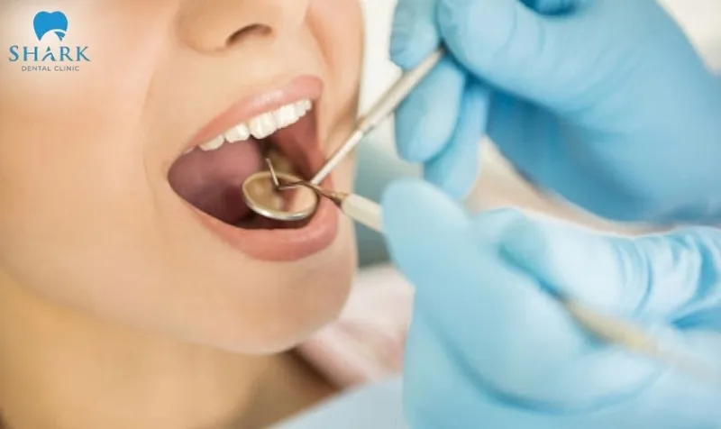Răng chết tủy có trám được không? Quy trình ra sao? 9 Nên khám sức khỏe răng miệng định kỳ 6 tháng/lần, để kịp thời phát hiện sớm những vấn đề của răng