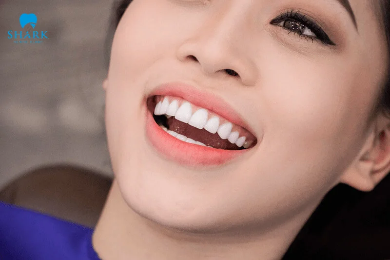 Top 7 người nổi tiếng có răng hô vẫn đẹp và duyên dáng 18 Bọc răng sứ để khắc phục dáng răng hô