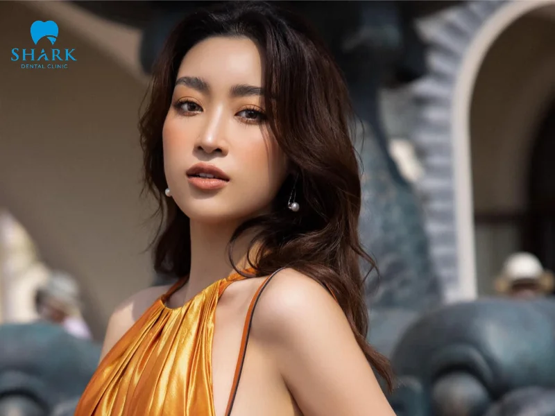 Top 7 người nổi tiếng có răng hô vẫn đẹp và duyên dáng 16 Hoa hậu Đỗ Mỹ Linh