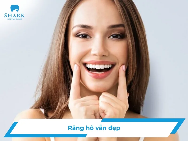Răng hô vẫn đẹp