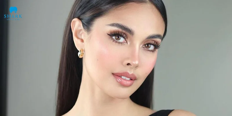 Top 7 người nổi tiếng có răng hô vẫn đẹp và duyên dáng 15 Hoa Hậu Megan Young