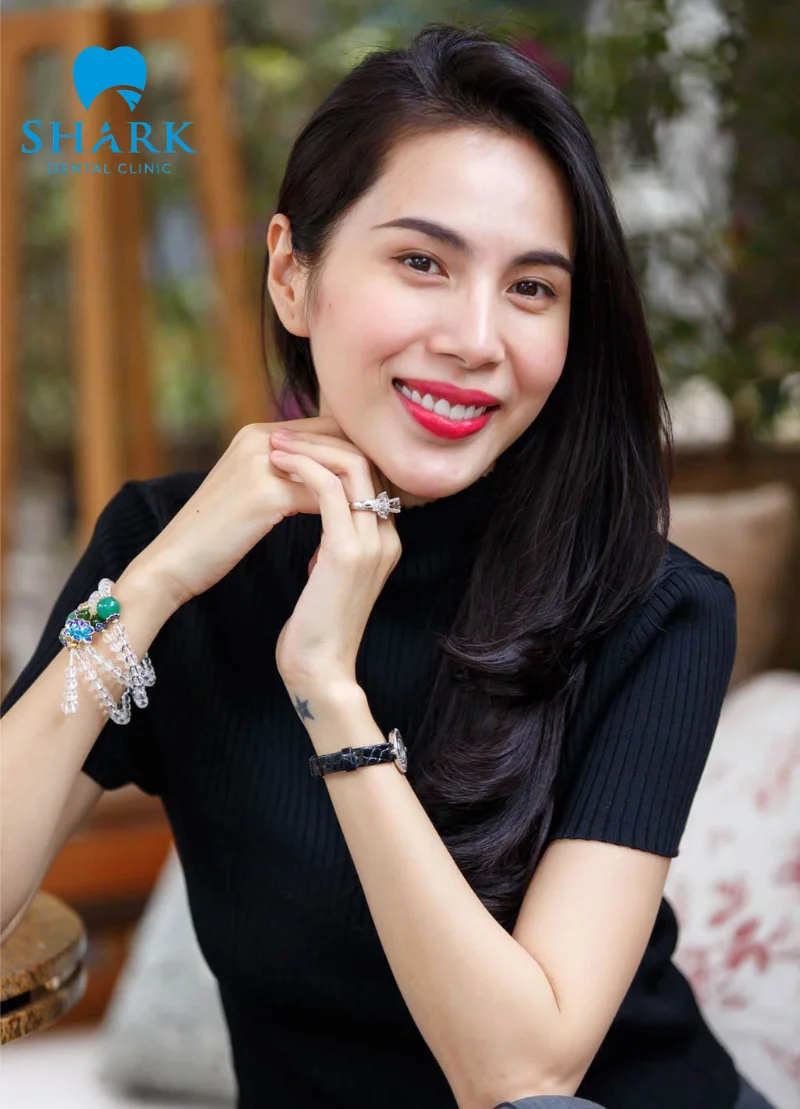 Top 7 người nổi tiếng có răng hô vẫn đẹp và duyên dáng 14 Ca sĩ Thủy Tiên