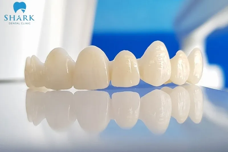 Cercon HT có tuổi thọ trung bình cao, trung bình khoảng 20-30 năm hoặc hơn