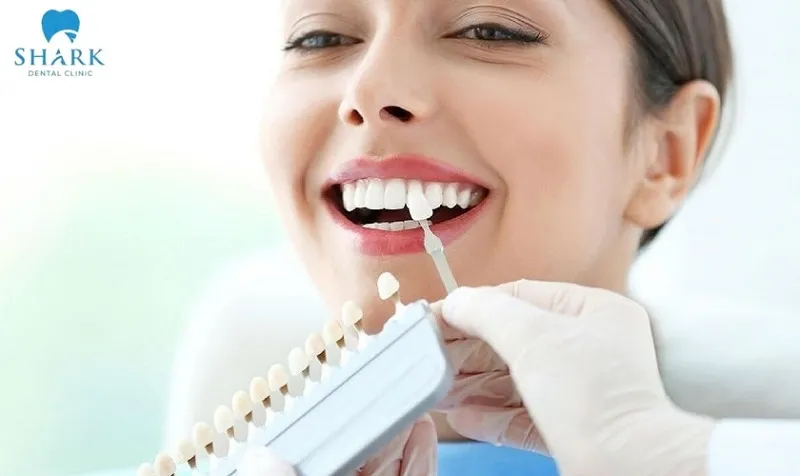 Răng sứ Cercon HT có 2 bảng màu phù hợp với nhu cầu đa dạng của khách hàng