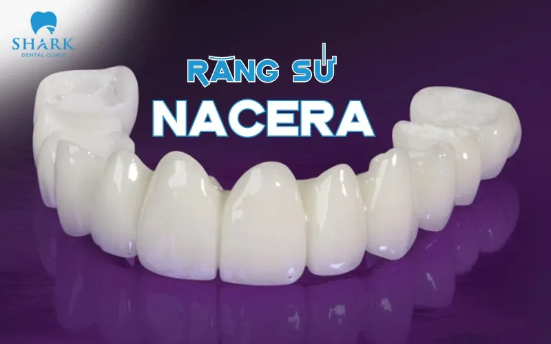 Răng bọc sứ Nacera là loại răng sứ chất lượng, cao cấp và được ứng dụng rộng rãi trên toàn Thế Giới