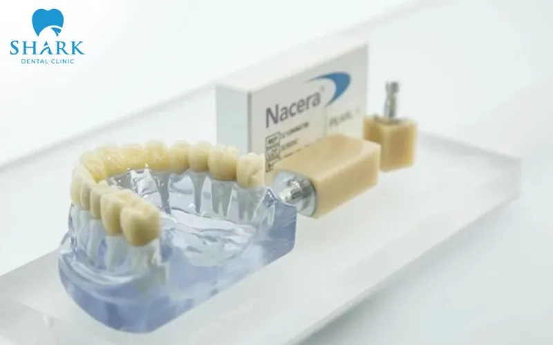Răng bọc sứ Nacera đem đến độ bền vượt trội với khả năng cách nhiệt hiệu quả đáp ứng nhu cầu thẩm mỹ cao