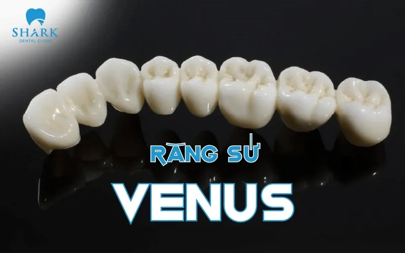Bọc răng sứ Venus là gì? Có tốt không? Giá bao nhiêu? 10 Răng sứ Venus là dòng răng toàn sứ cao cấp được chế tác từ 100% phôi sứ nguyên chất với độ bền cao