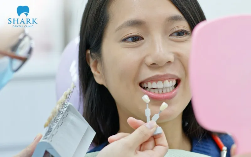 Bọc răng sứ Venus là gì? Có tốt không? Giá bao nhiêu? 13 Răng bọc sứ Venus được đánh giá cao về tính thẩm mỹ tự nhiên và tuổi thọ duy trì lâu dài